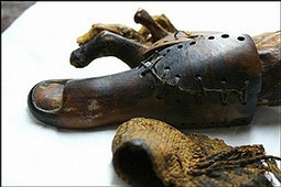 Prothese du pied de l'Antiquite Egyptienne