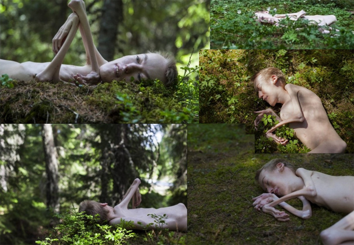 Torstein Lerhol, une personne handicape norvegienne, pose nue pour protester contre le diktat de la beaute