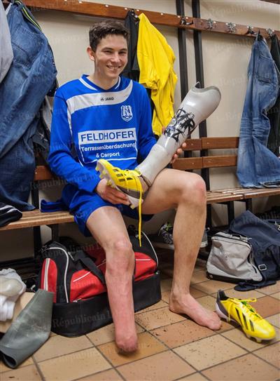 Martin Hofbauer, joueur de football et amputÃƒÂƒÃ‚Â© d'une jambe